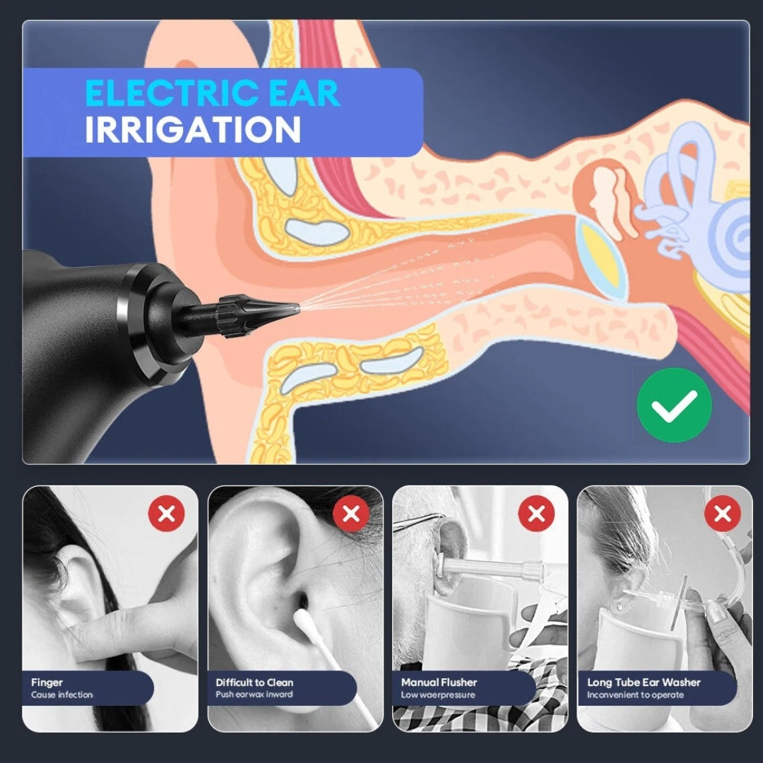 Ryzewell™ - Ear Wax Remover