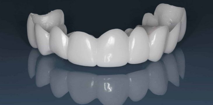 SnapBright™ Snap-On Veneers